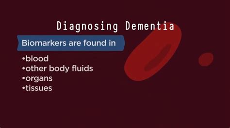 How Biomarkers Help Diagnose Dementia .